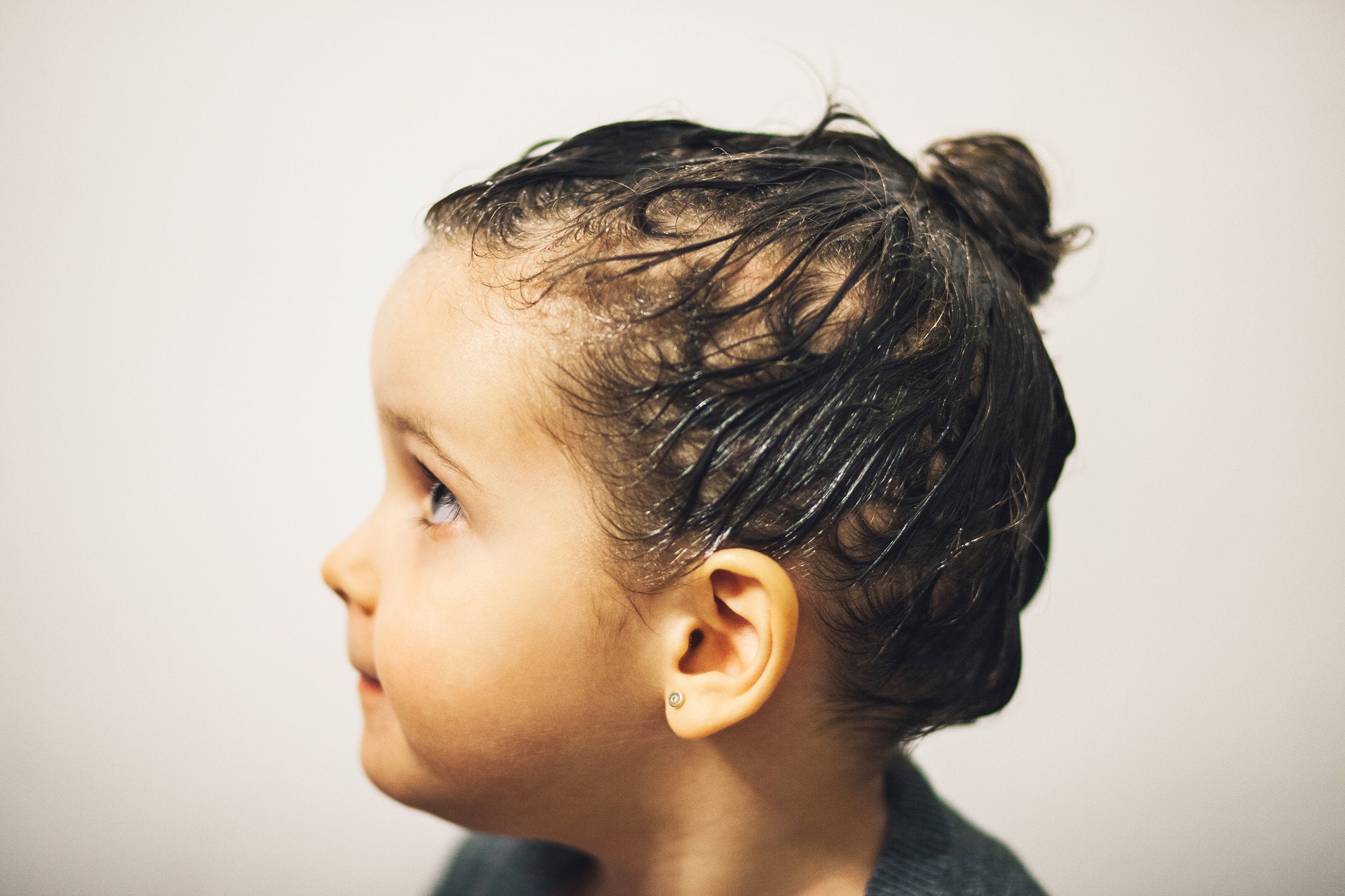 What is the best treatment for lice?